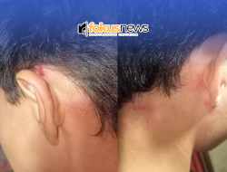 Remaja 15 Tahun Diduga Jadi Korban Penganiayaan Oknum Polisi di Gorontalo