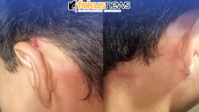 Remaja 15 Tahun Diduga Jadi Korban Penganiayaan Oknum Polisi di Gorontalo